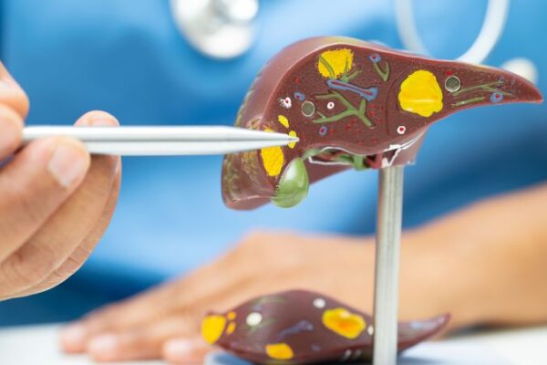Alcoholic Hepatitis Treatment Market Size, Share – 2034 Alcoholic Hepatitis Treatment Market