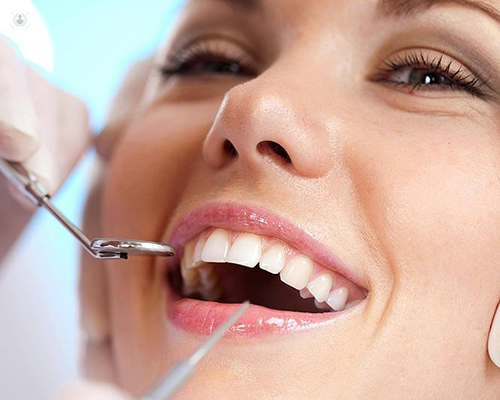 Crafting Your Perfect Smile: The Expertise of Cosmetic Dentists in Tampa Cosmetic Dentist Tampa