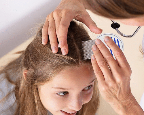 Master the Art of a Simple Head Lice Check Head Lice Check